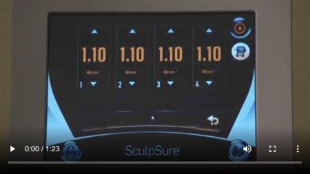 Sculpsure Patient Treatment Video